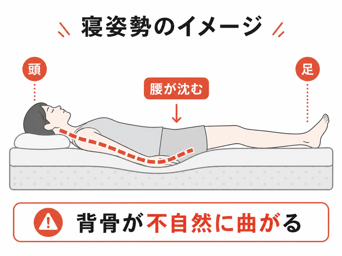 柔らかすぎマットレスの寝姿勢：腰が沈み背骨が不自然に曲がるイメージ